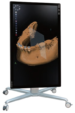 Asclepius-65 4K Virtuální anatomické pitevní stoly Asclepius: Virtuální pitevní stůl Asclepius 65 4K